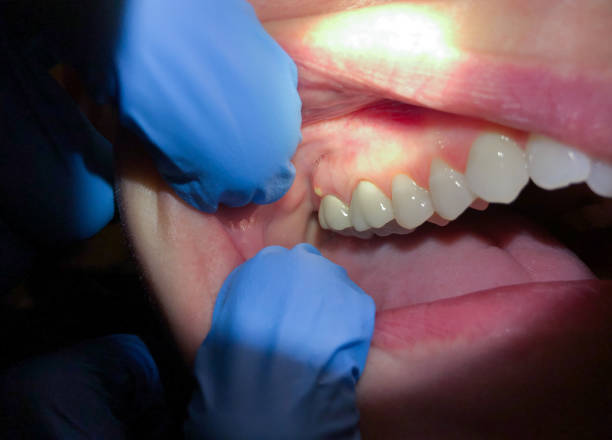 Best Urgent Tooth Repair  in Vernal, UT