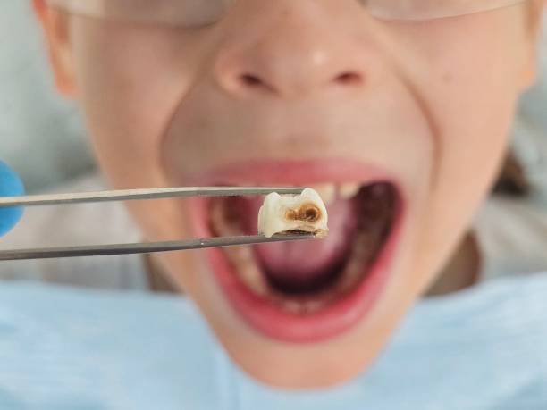 Best Tooth Infection Emergency Dentist  in Vernal, UT